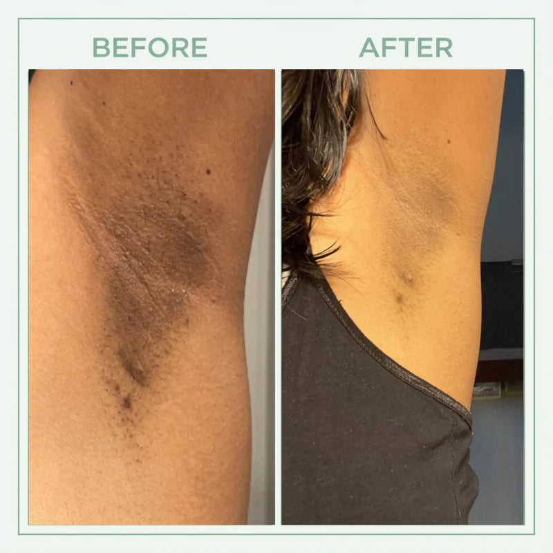 Elevare™ Core Skin Bright Peel Spray