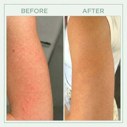 Elevare™ Core Skin Bright Peel Spray