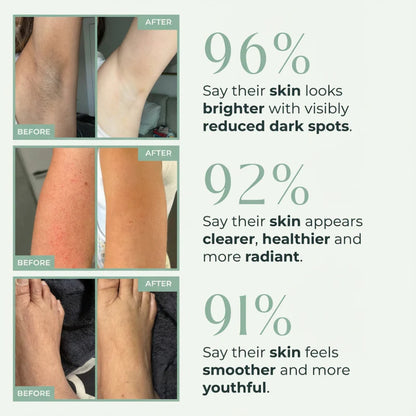 Elevare™ Core Skin Bright Peel Spray