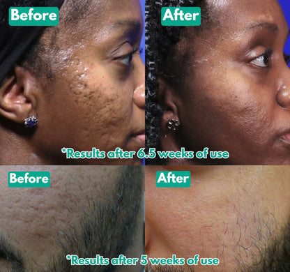 Microcrystal™ Serum PM Duo