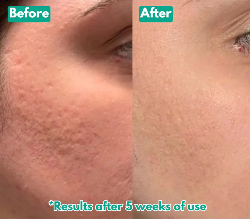 Microcrystal™ Serum PM Duo